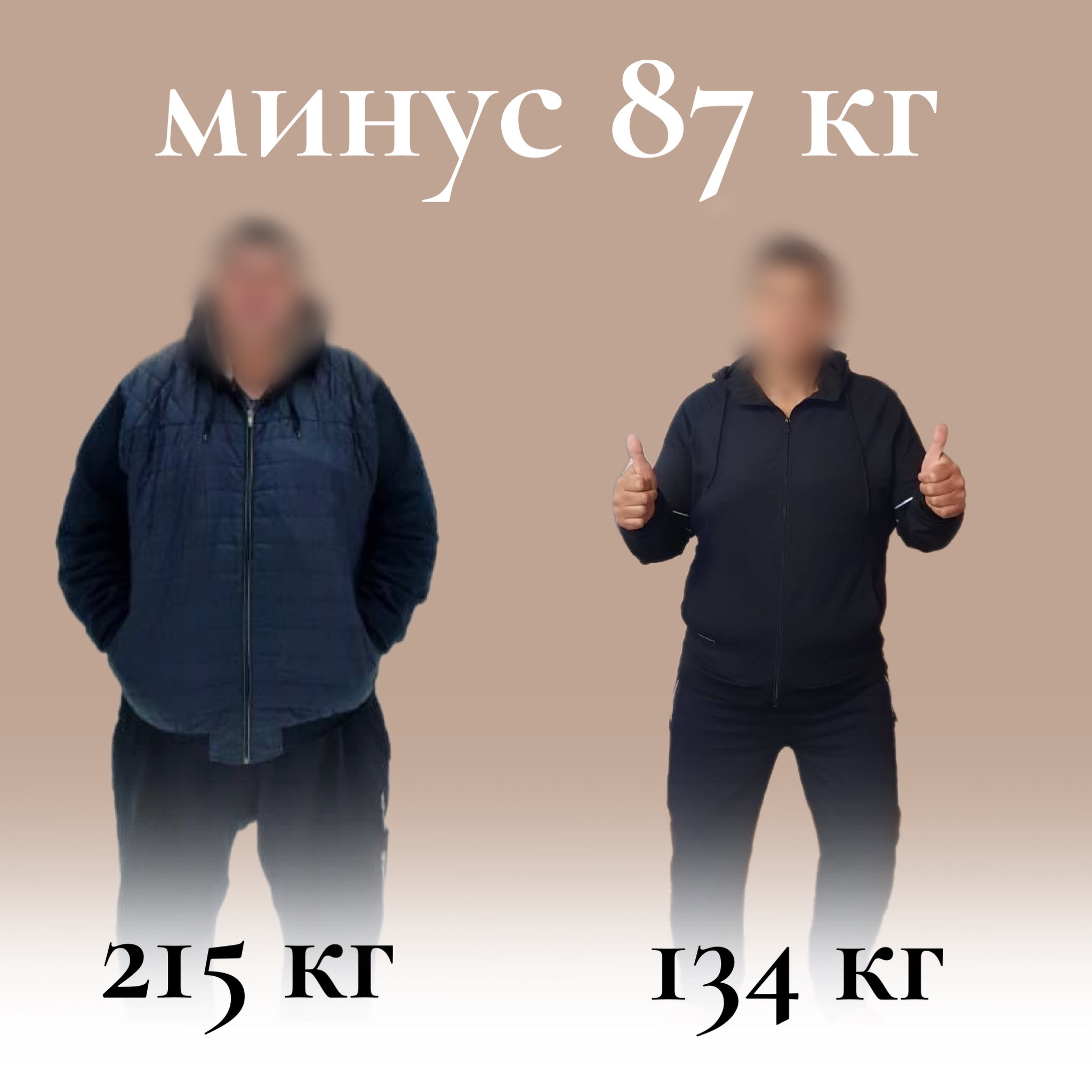 Результат бариатрической операции: минус 87 кг